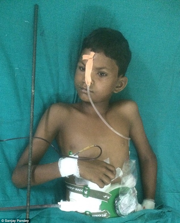 Miracle: Ten year old Aman Vishwakarma (pictured) was working on the roof of his family home in Kaushambi district in Uttar Pradesh state, India, when he fell and impaled himself on a four foot long steel rebar